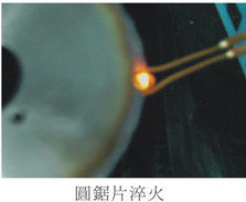 超高周波 1-2MHz 誘導溶解装置